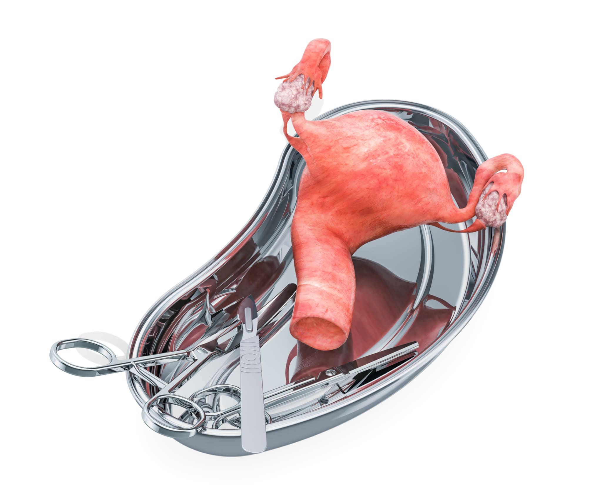 Uterustransplantation Sicher und effektiv bei Lebendspende in