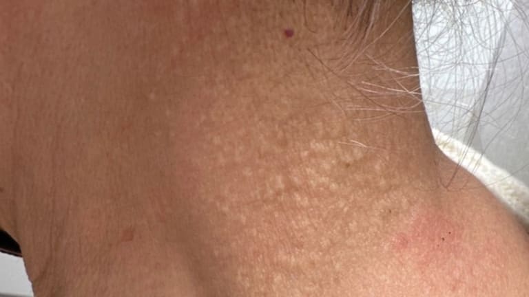 Bild der Woche: Kopfsteinpflaster am Hals