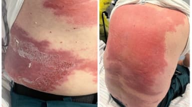 Bilder des Fallberichts