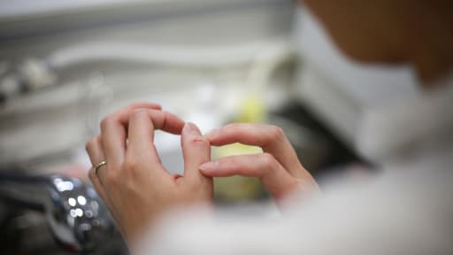 Eine Frau, die an Rhagaden leidet