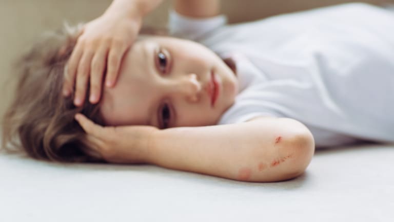 Kind liegt nach einem Sturz auf dem Boden und hält sich mit den Händen den Kopf