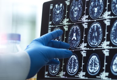 KI in der Medizin: Wo ist sie Ärzten überlegen?