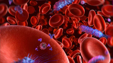 Sepsis