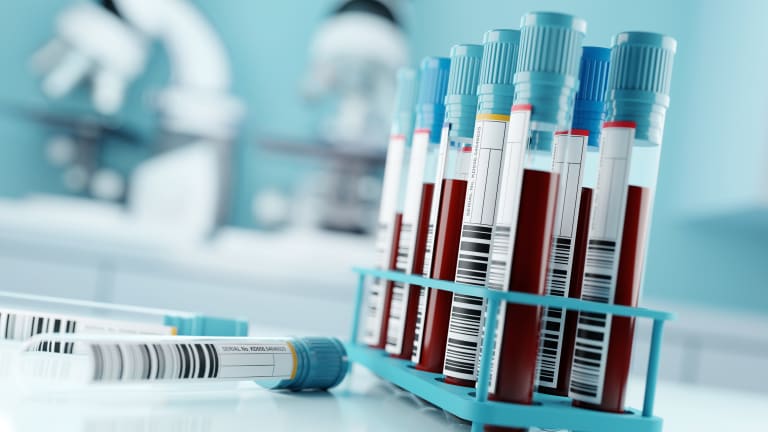 Abnorme Laborwerte nur im Kontext interpretieren – viele Tests sind unnötig