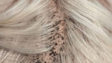 Blonder Junge mit schwarzen Punkten auf dem Kopf