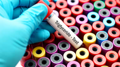 Triglyzerid-Test Labor
