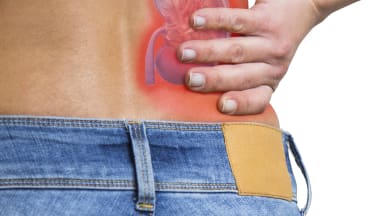 Nierensteine mit erhöhtem Krebsrisiko assoziiert