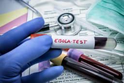 Ebola im Kongo: Wie gefährlich ist der Ausbruch?