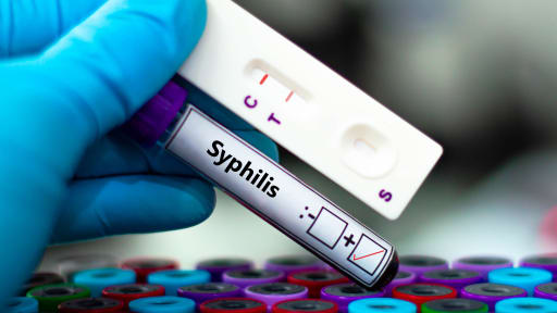 Syphilis in Deutschland auf dem Höchststand