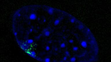 Stilles X-Chromosom