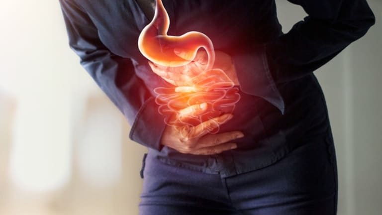 Bauchbeschwerden ohne Befund: Ärzte stoßen auf eine überraschende Ursache