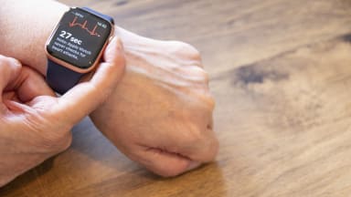 Apple-Watch