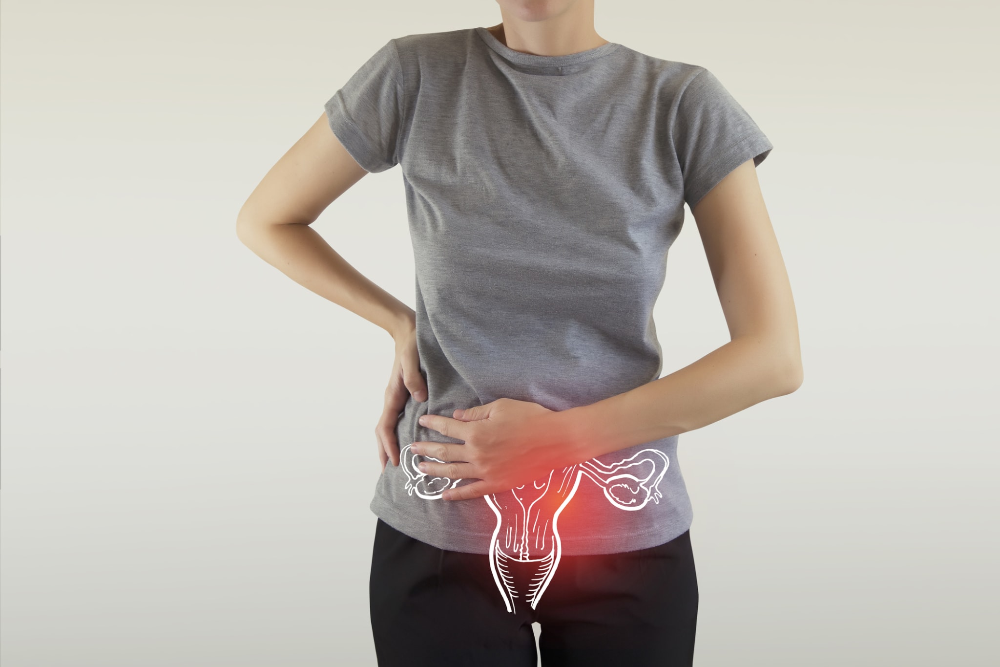 Vulvakrebs mit Befall des Wächterlymphknotens - coliquio