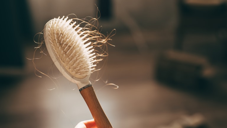 Neuer Wind in der Therapie von kreisrundem Haarausfall