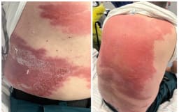 Bilder des Fallberichts