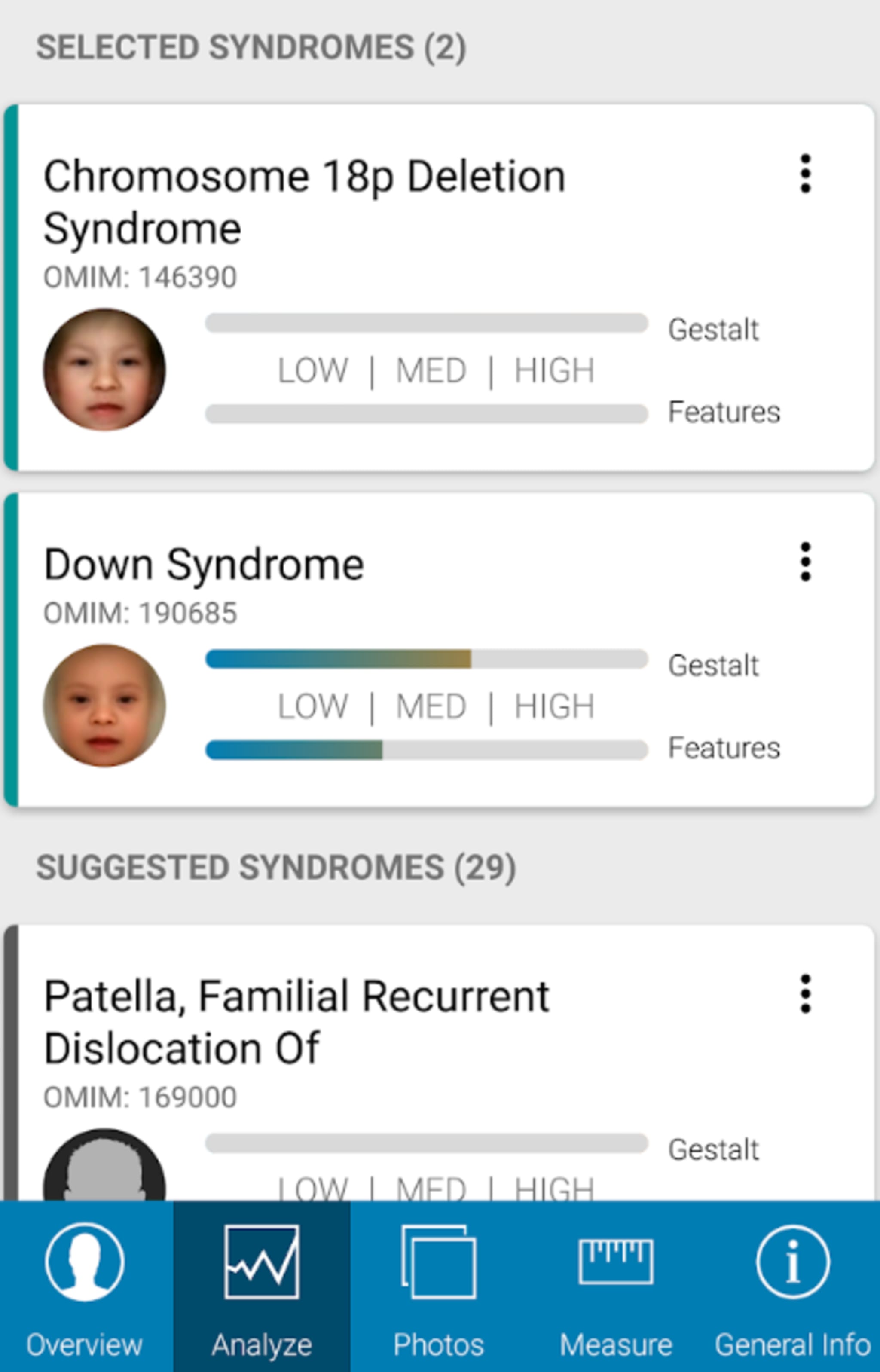 In der Analyse zeigt die App in einer Rangliste die Erbkrankheiten an, die am wahrscheinlichsten vorliegen. In diesem Fall wurde das Down-Syndrom erkannt. 
