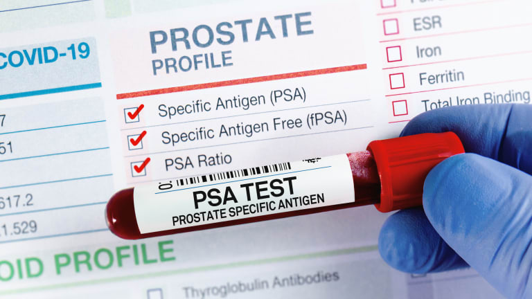 Cochrane Review: PSA-Screening senkt wahrscheinlich die Sterblichkeit durch Prostatakrebs