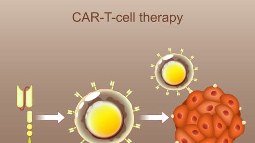 car-t-zelltherapie