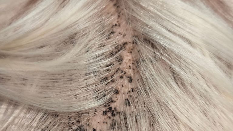 Blonder Junge mit schwarzen Punkten auf dem Kopf