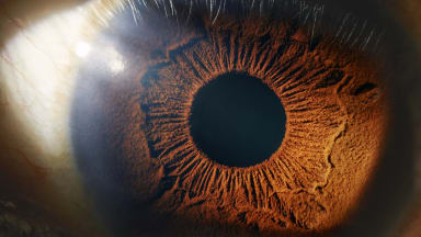Statine? Vielleicht geben die Augen Aufschluss