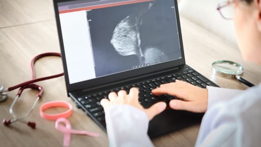 Neue Wege in der Brustkrebs-Früherkennung 