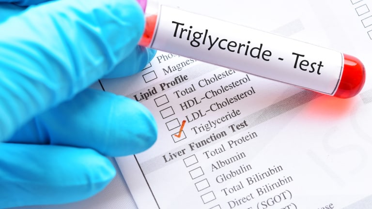 Triglyzeride-Test