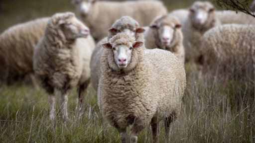 Gelenkschmerzen, erhöhte ANA-Titer, Perikarderguss: Das mysteriöse Krankheitsbild einer 36-Jähriger