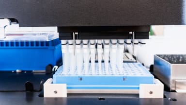 NGS bei Gallengangsstrikturen: Wenn die Pathologie an Grenzen stößt