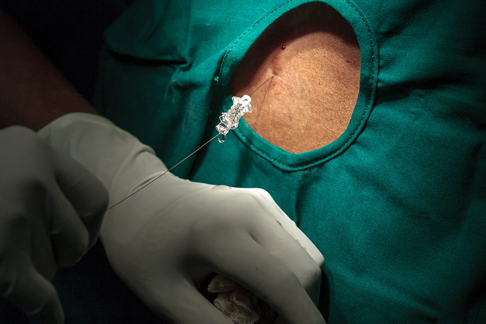 The No. 1 Gama Mistake You're Making and 5 Ways To Fix It