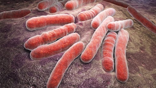 Neuer rekombinanter Hauttest zum Nachweis einer Tuberkulose