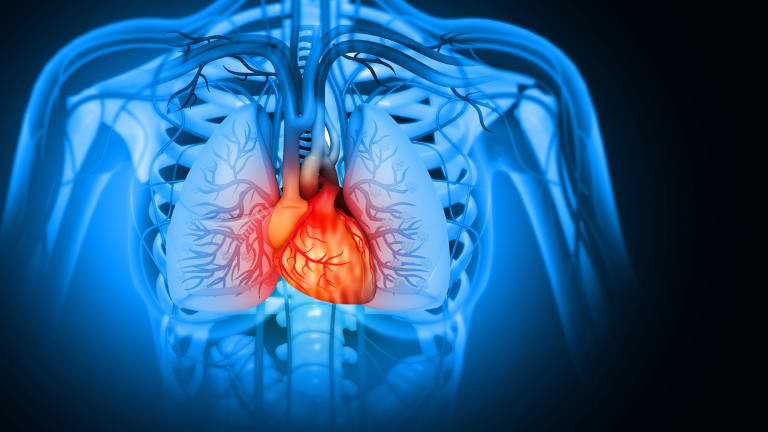 KHK und Genetik: Gen- Risiko-Scores zur Prävention