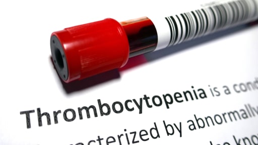 Thrombocytopenia