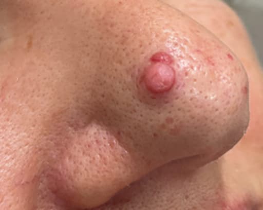 Gestielte pinke Papel auf der Nase