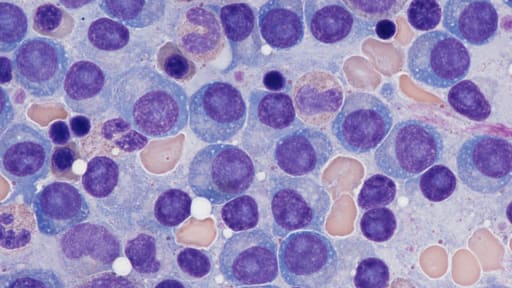 multiplesmyelommikriskop