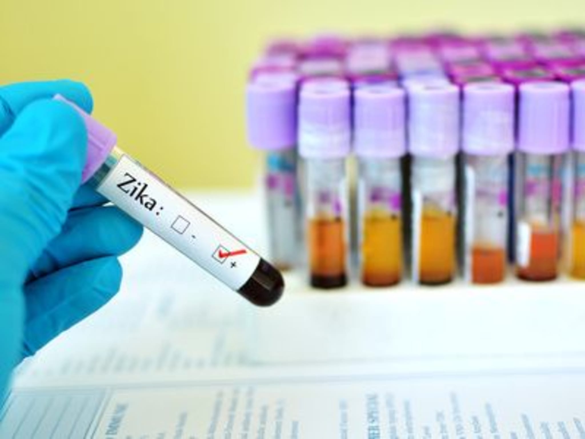 ZikaVirus Die wichtigsten Fakten im Überblick