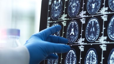 KI in der Medizin: Wo ist sie Ärzten überlegen?
