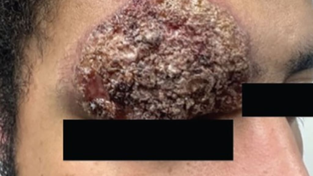 Bild der Woche: Verkrustete Augenbraue