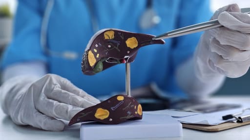 Ein Mann mit Leberschäden nach Apfelessigeinnahme