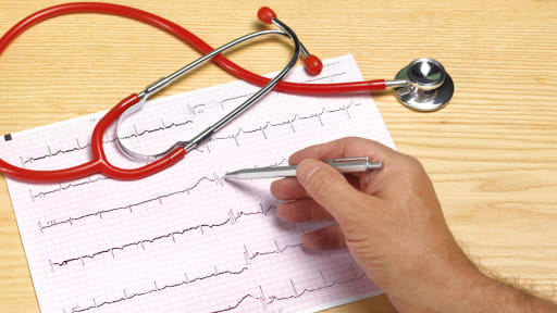 Gefäßverschluss am Auge: Internistische Abklärung