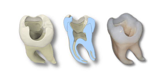 3D-gedruckte Zähne bieten vielseitiges Übungsmaterial für Studierende