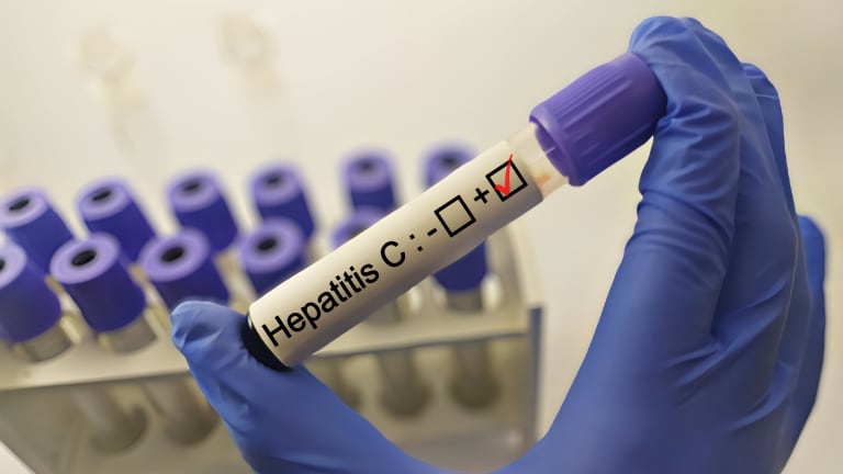 Neue Weltkarte der HCC auslösenden Hepatitiden