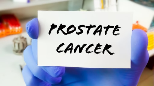 Neue ESMO-Leitlinien zum lokalisierten Prostatakarzinom