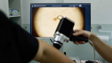 skin cancer screening