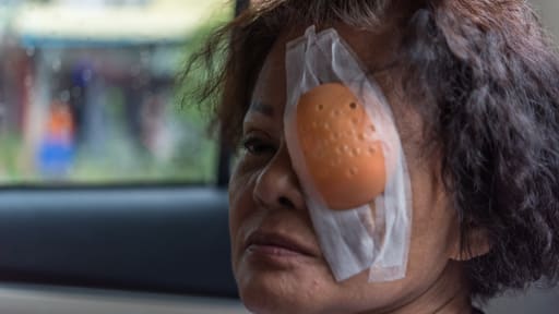 Nachsorge: Macht ein Tag einen Unterschied?