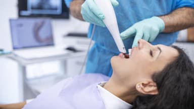 Intraoralscan