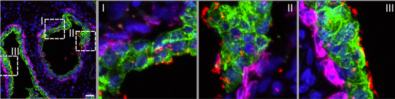 Die geheime Route einer Prostata Infektion
