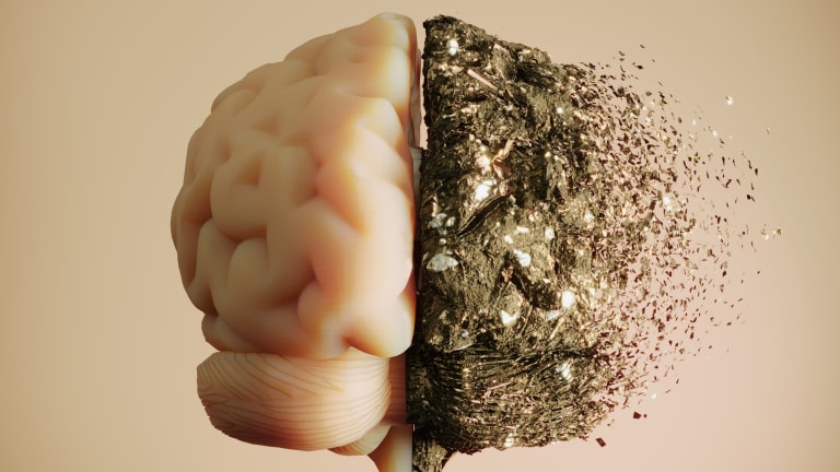 DGIM 2026: Studie zu Lithiumcarbonat bei Alzheimer-Demenz negativ